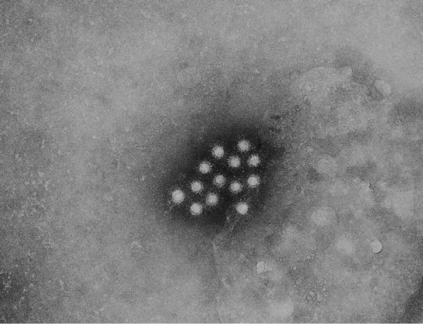 Wirus zapalenia wątroby typu A zdj. udostępnione przez CDC