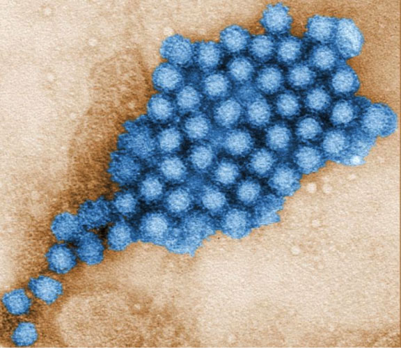 Norovirus, zdj. udostępnione przez CDC