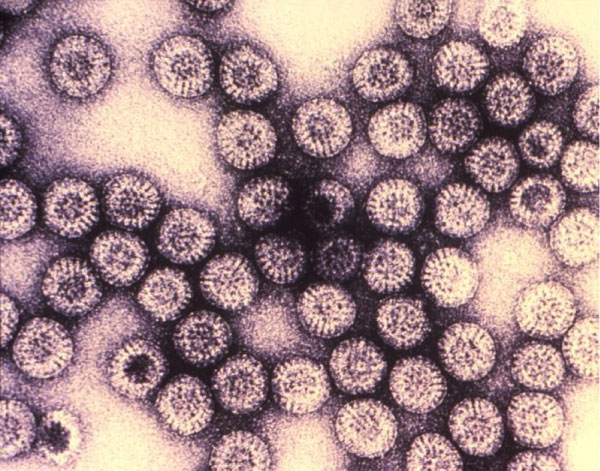 Rotawirus, zdj. udostępnione przez CDC